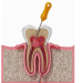 What Are the Benefits of a Root Canal?