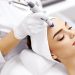Microneedling Health Benefits 2022